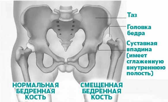Основные элементы сустава